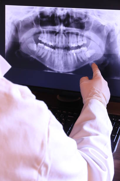 Best Emergency Wisdom Teeth Removal in Poteet, TX